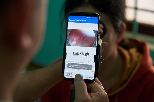 중저소득국가 당뇨로 인한 실명, '아이라이크(EYELIKE)'로 조기 예방